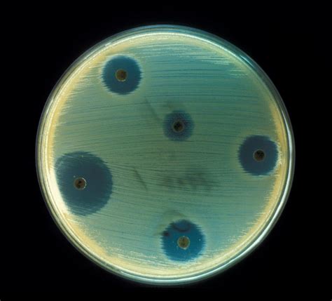 El Descubrimiento De La Penicilina De Alexander Fleming