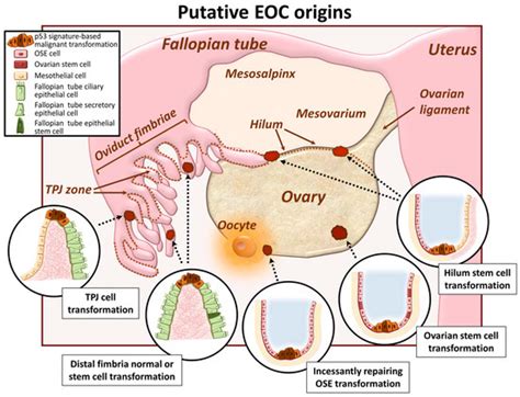 Most cases are diagnosed in an advanced stage. Cancers | Free Full-Text | Complex Determinants of ...