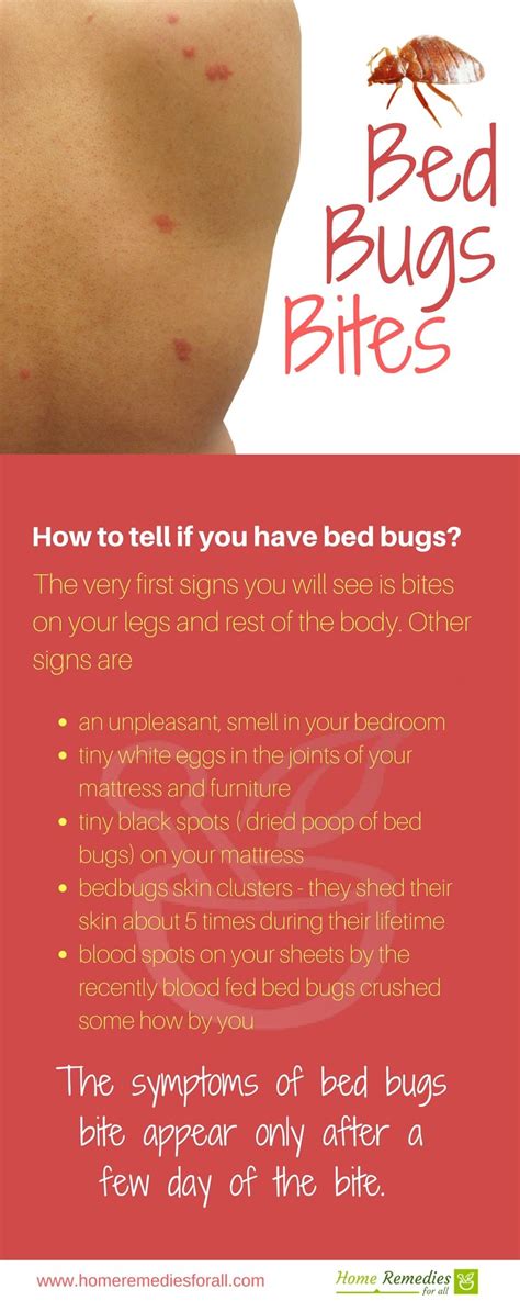 Find Out How Bed Bug Bites Symptoms Develope Bed Bug Bites Bed Bugs