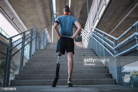 Male Leg Amputee Photos And Premium High Res Pictures Getty Images