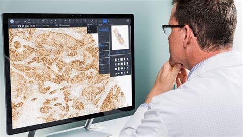 Digital Pathology Roche And Pathai Team Up Healthcare In