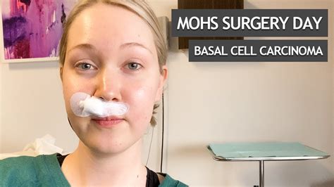 Mohs Surgery Day For Basal Cell Carcinoma Youtube