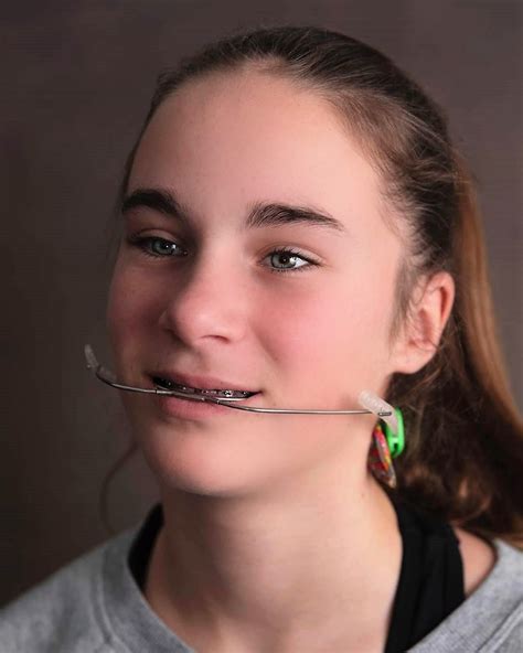 Braces Girls Metal Braces Teeth Braces Lany Headgear Dental Nose