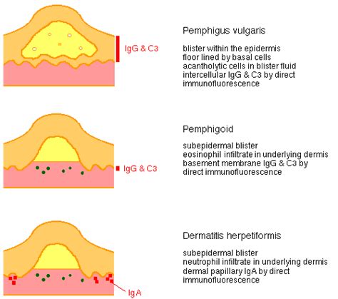 Diagram Of Bullous Skin Diseases Gpnotebook