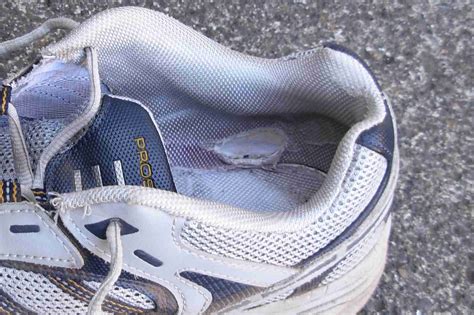 Most cacti respond well to excising the diseased tissue. What Shoe Wear Patterns Mean About Your Gait