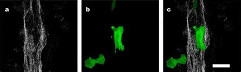 Aligned Collagen Matrix Influenced Cell Morphology Bovine Aortic