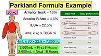 Parkland Formula for Burns: Pediatric and Adult Examples, Calculator ...