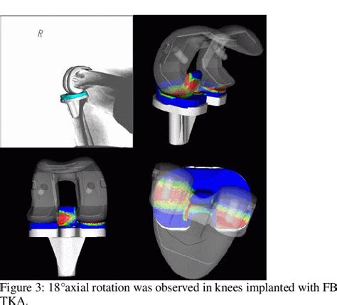 Figure 3 From Comparison Of In Vivo Kinematics During Deep Knee Bending