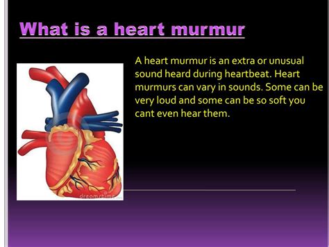 Ppt Heart Murmur Powerpoint Presentation Free Download Id2331076