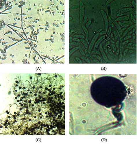 Antagonism Of Pseudomonas Putida Against Dematophora Nectarix A Major