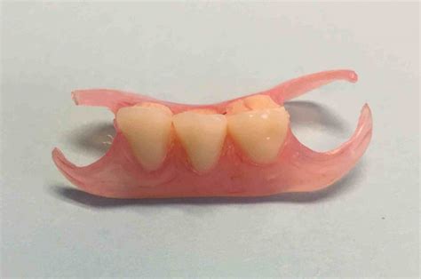 Valplast Flexible Partial Denture Dr Gentry