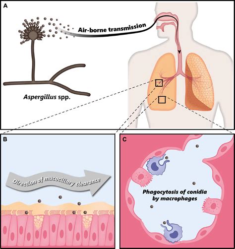 Frontiers Recent Advances In Fungal Infections From Lung Ecology To