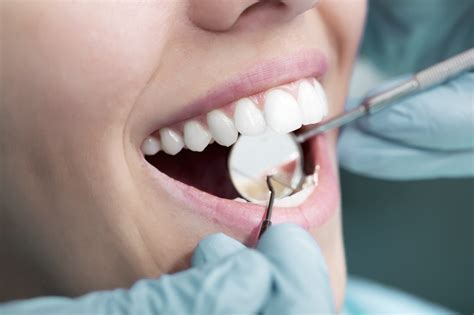 Dental Exam Vancouver | Shen Dental Clinic Vancouver