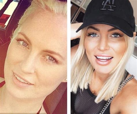 Bachelor In Paradises Keira Maguire Reveals Truth About Her Plastic Surgery Womans Day