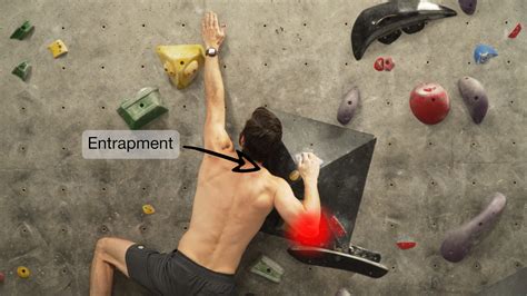 Why Climbers Get “phantom” Elbow Pain And How To Fix It — Hoopers Beta