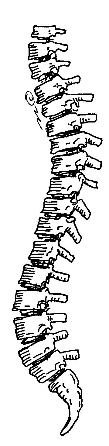 In many bones, the cancellous bone protects the innermost part of the bone, the bone marrow (say: Morris Classical Academy: Muscle & Bone