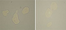 Entamoeba histolytica trophozoites observed under the microscope stain ...