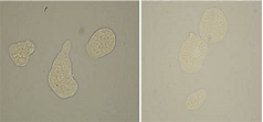 Entamoeba histolytica trophozoites observed under the microscope stain ...