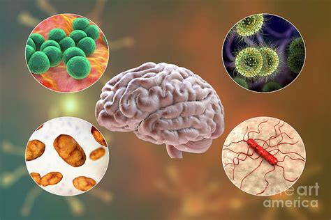 Causes Of Bacterial Meningitis Photograph By Kateryna Konscience Photo