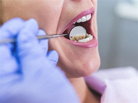 Are you looking to find out how to stop sensitive teeth pain immediately? 10 Home Remedies To Stop Sensitive Teeth Pain