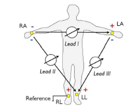 12 Lead Ecg Limb Electrode Placement