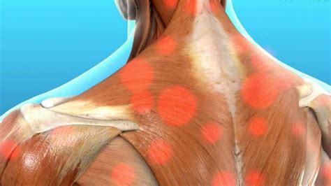 Myofascial Release Therapy Can Help When Treating Cancer