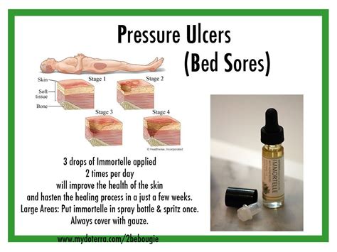 Bedsores Also Called Pressure Ulcers Or Decubitus Ulc