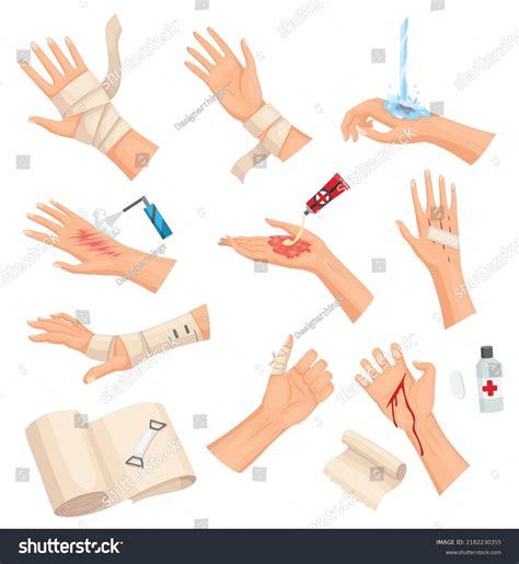 Hands Injured Skin Procedures Bandaging Wound Stock Vector Royalty