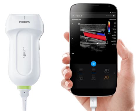 Philips Lumify Benefits Of Ultrasound Extended To More Places Than Ever