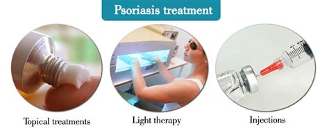 Psoriasis Symptomcausestypes And Treatment How To Relief