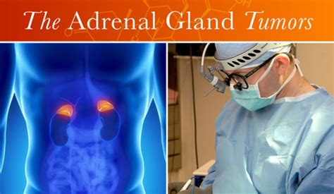 Disease Of The Adrenal Gland Bdawatcher