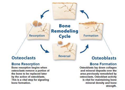 Pdfs zusammenfügen ist ganz einfach. Remodeling Of Bone - Bone Formation And Remodeling Tobig ...