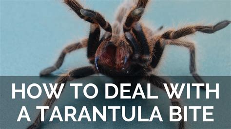 How To Deal With A Tarantula Bite What To Do And When To Get Help