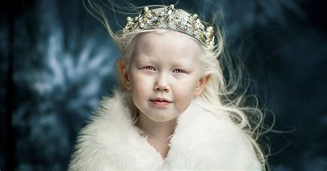 8 Year Old Albino Snow White From Siberia Takes Fashion
