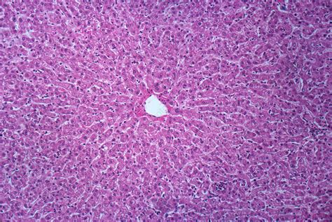 Human Liver Lm Stock Image C0175948 Science Photo Library