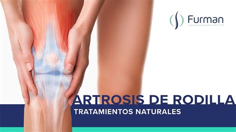 Artrosis De Rodilla Gonartrosis Osteoartritis Tratamientos