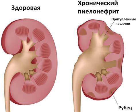 Диета певзнера 4б диета певзнера книга | Kidney infection causes, Kidney infection диета певзнера книга | Kidney infection causes, Kidney infection Диета певзнера 4б
