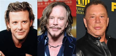 Mickey Rourke Plastic Surgery Before And After Pictures 2021