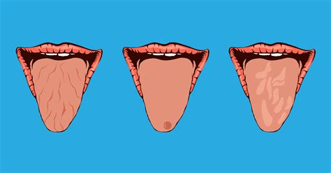 9 Secrets Your Tongue Can Reveal About Your Health
