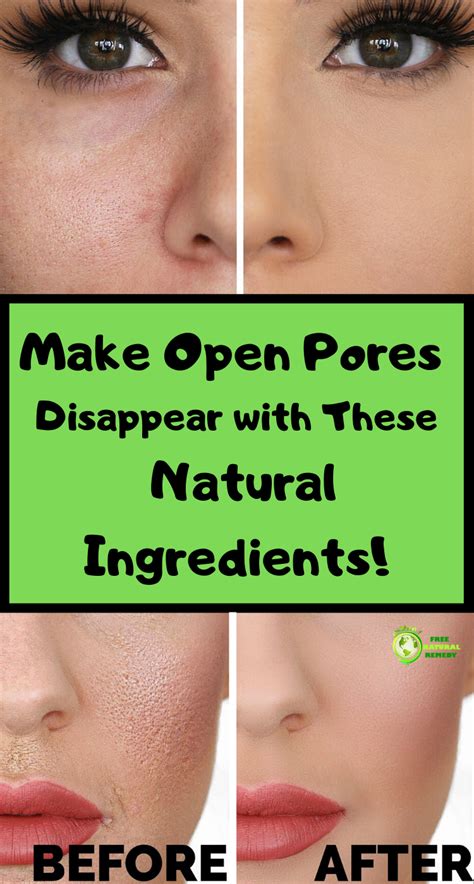 For instance, cancer cells in the lung How To Make Your Open Pores Shrink Using Only Natural ...
