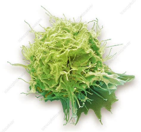 Herpes Virus Infected 293t Cell Sem Stock Image C0401028