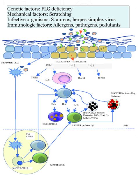 Pathogenesis Of Atopic Dermatitis Damage To The Skin Barrier Allows