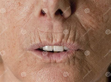 Wrinkle Lips Senior Wrinkles Stock Image Image Of Mimic Surgical