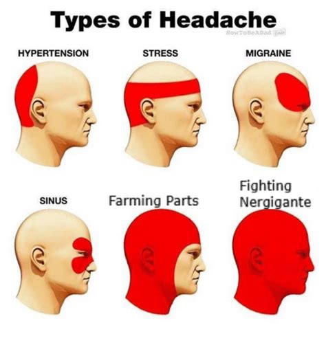 Learning and development is one of the two key areas of the eyfs. Types of Headache HowToBeADad HYPERTENSION STRESS MIGRAINE Fighting Nergigante SINUS Farming ...