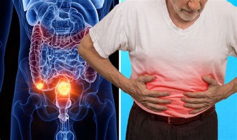 Bowel Cancer Symptoms Pain In The Abdomen Could Be Indicative Of The