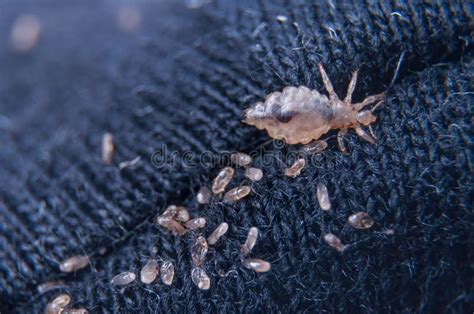 Chewing Louse Stock Photos Free And Royalty Free Stock Photos From