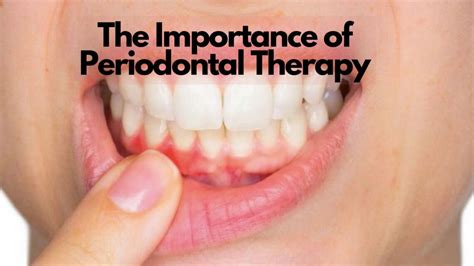 Non Surgical Periodontal Therapy Sheehan Dental Clinic In Palos Park