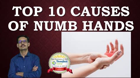 Top 10 Causes Of Numbness In Hand Youtube