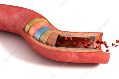 Sectioned Blood Vessel Artwork Stock Image C0200784 Science