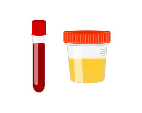 Test Tube With Blood And Urine Sample Container Isolated On White